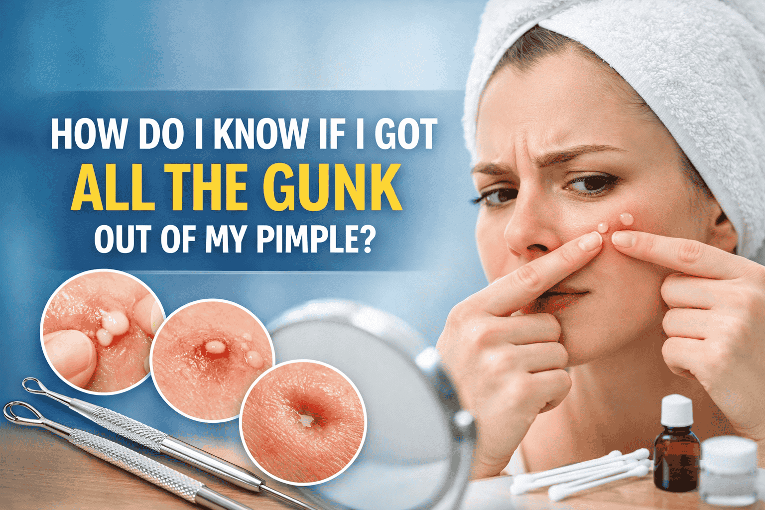 should you squeeze the clear liquid out of a pimple
